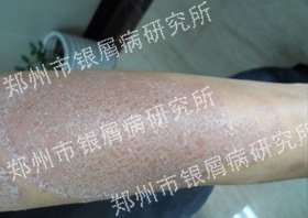脱去“牛皮”,焕然新生!