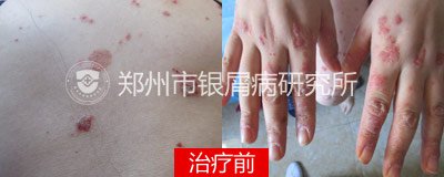 ���á����ء��ٵ��ҵ�Ƥ��