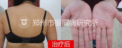 ���á����ء��ٵ��ҵ�Ƥ��