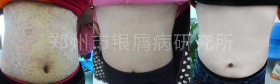 ��м���緢�������Ʋ����翵��