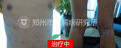 ���ֵ��������м������