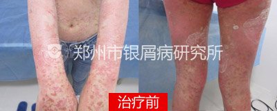 ��Ů��м��ĥ